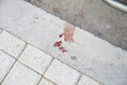 Δολοφονία 20χρονου αθλητική βία Θεσσαλονίκη