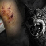 επίθεση σκύλου Μεσαρά 12χρονος τραυματίες