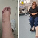 ατύχημα Άραξος τελετή TUI τραυματίες